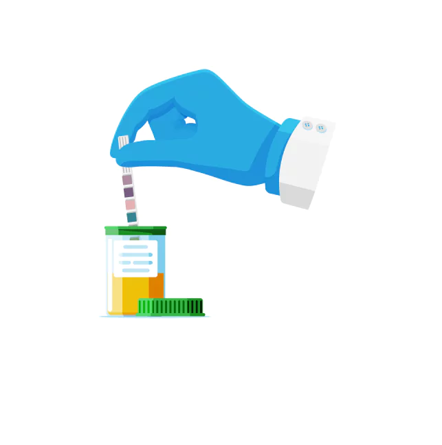 Urine Complete analysis